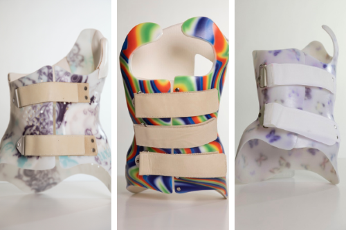 Three images of spinal braces decorated with colourful patterns are displayed in front of white backgrounds.